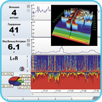 Отображение данных на мониторе церебральных функций «Энцефалан-ЦФМ». Вариант «Элитный». Дополнительные возможности
