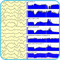 Пример одновременной визуализации физиологических сигналов и трендов расчетных показателей