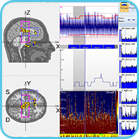 Тренды нейромониторинга, тренды ЦФМ и 3D-локализация