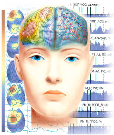 Electroencephalographic analyser