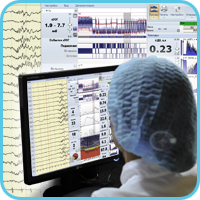 Нейромониторинг или мониторинг церебральных функций в ПИТ, реанимации и неонатологии