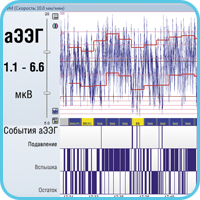 Отображение данных на мониторе церебральных функций «Энцефалан-ЦФМ». Вариант «Профессиональный»