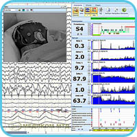 View of EEG-PSG-videomonitoring data, indices trends, sleep events and hypnogram built